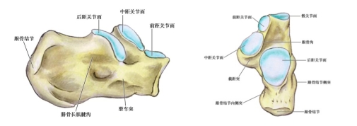 跟骨粉碎性骨折案例
